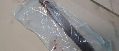Homem que esfaqueou companheira e causou perda da visão de um olho é condenado a mais de 35 anos de prisão em SC