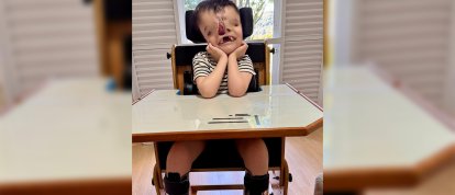 VÍDEO: família faz campanha para arrecadar valor de cirurgia de urgência para criança com malformação rara